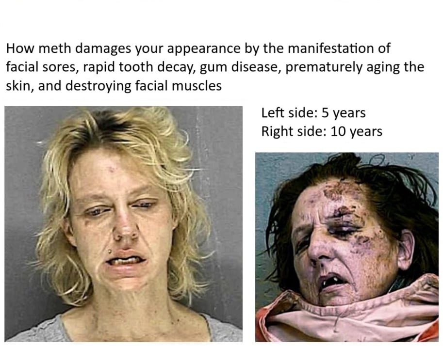 Prosecutor Treats Adderall Like Meth: Is This Justice or Madness?